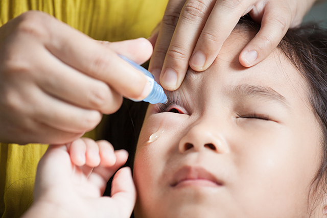 Conjuntivitis