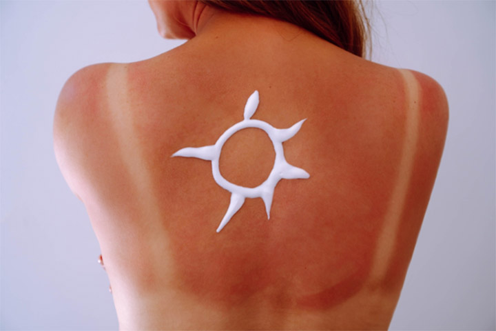 Es importante revisar tu piel regularmente y acudir a un especialista de la piel