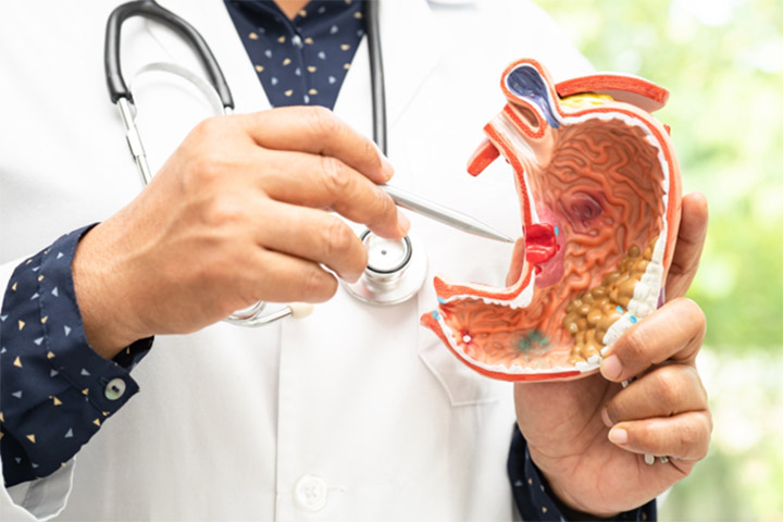 problemas gástricos pueden detectarse a tiempo con revisiones médicas periódicas