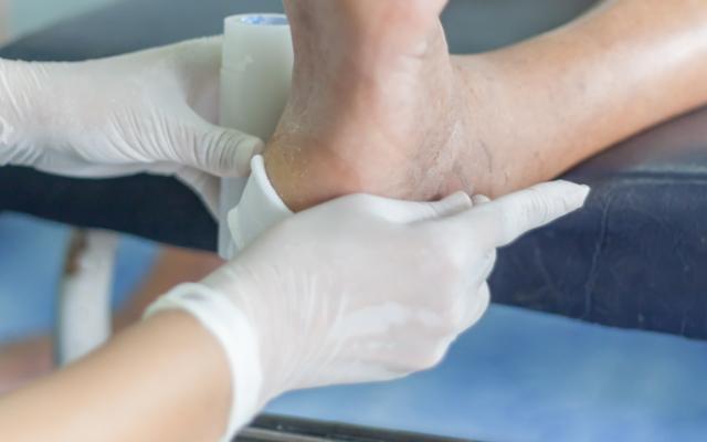 médico trata pie diabético