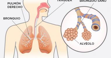 Que Es La Balanitis Sintomas Y Tratamiento Bupa