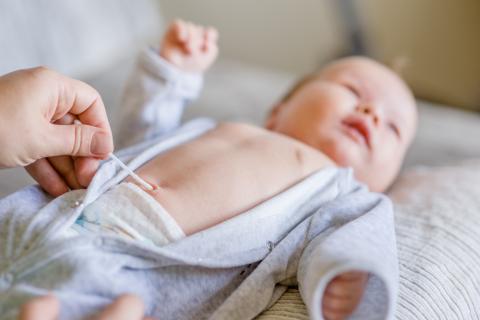 Hernia Umbilical Diagnostico Y Reparacion Bupa