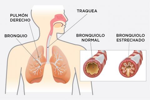 Sistema respiratorio - EPOC